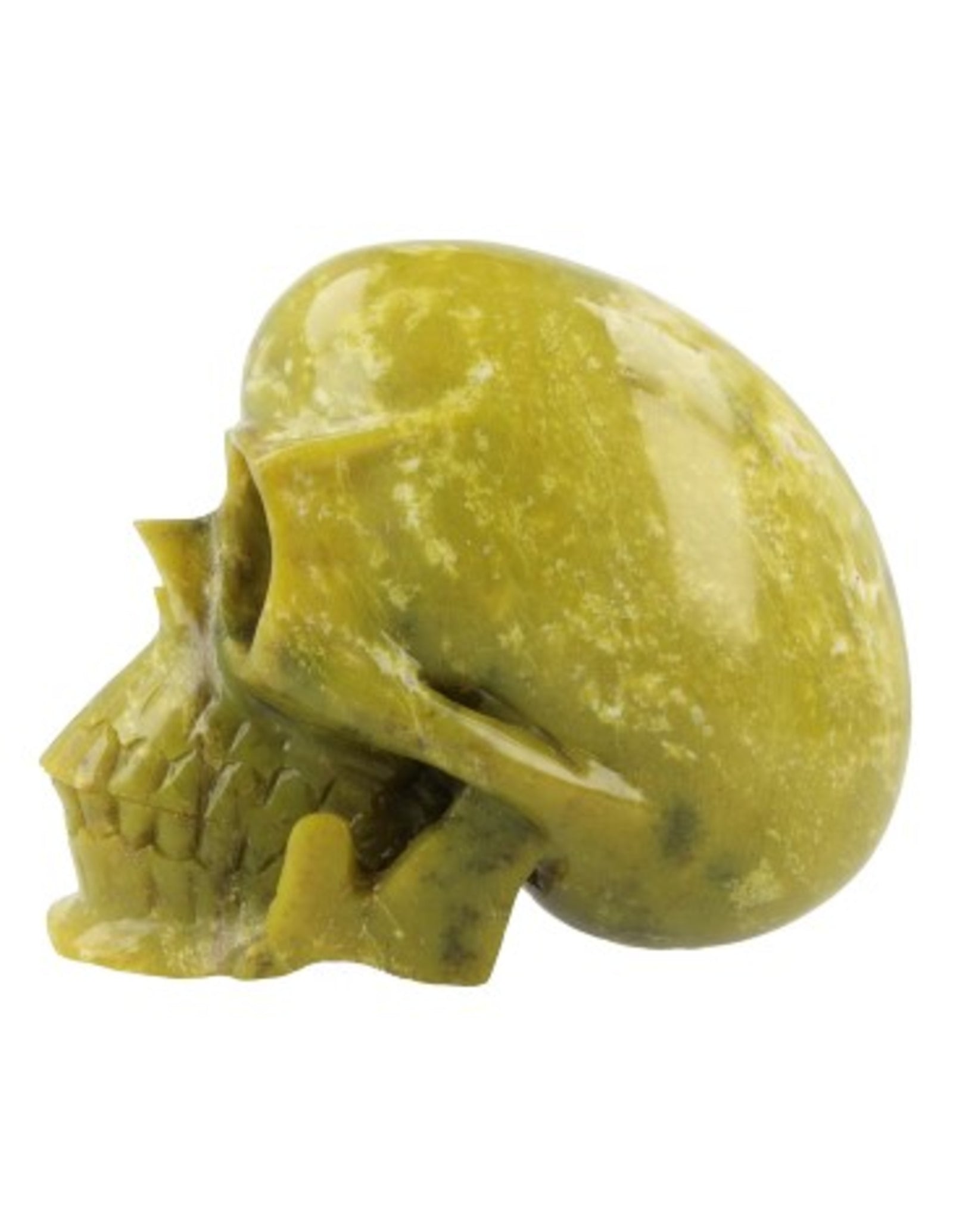 Nefriet schedel